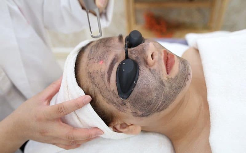 Laser Carbon – Làm sáng da, hỗ trợ ngăn ngừa lão hoá