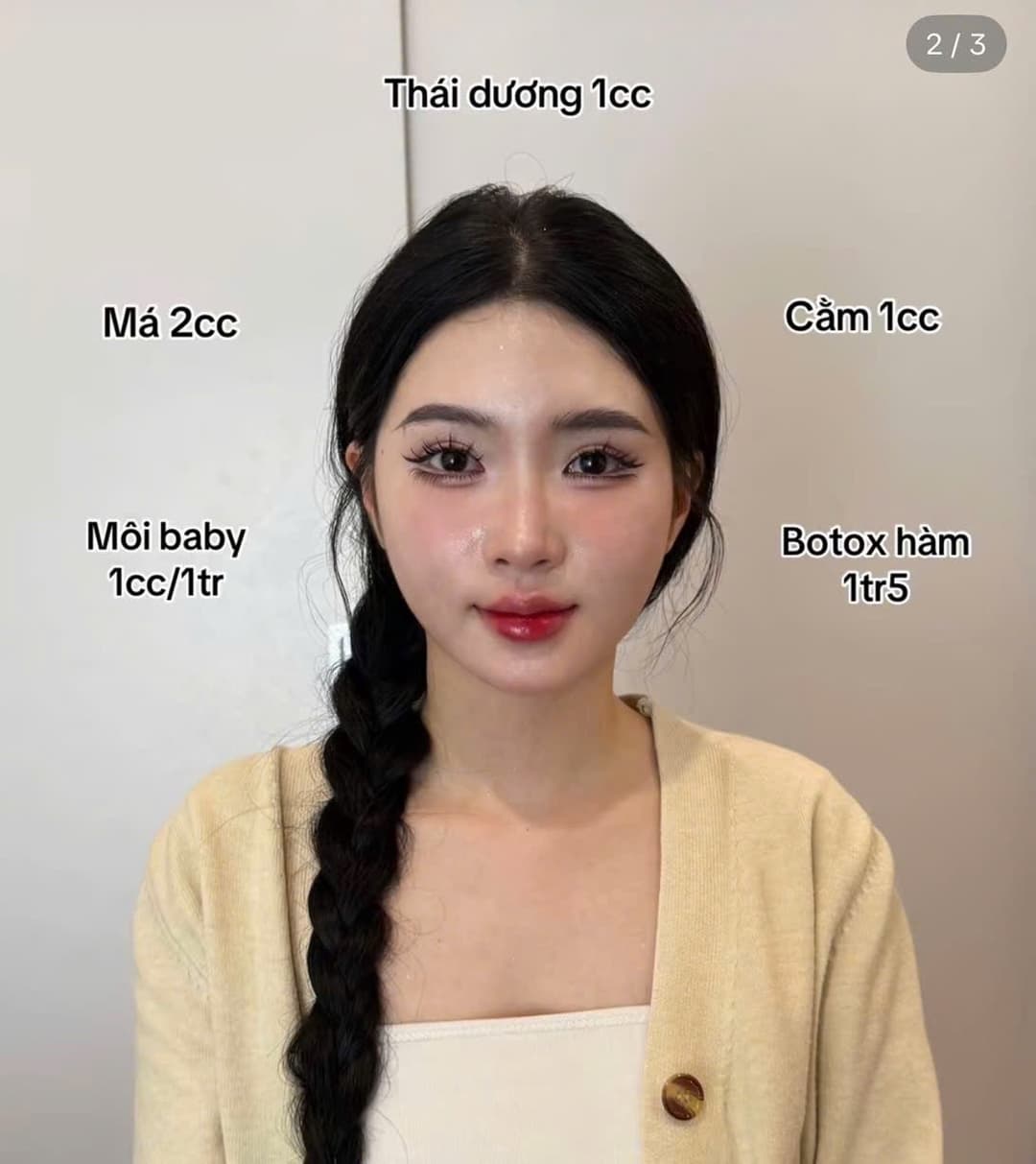 Căn chỉnh Full Face – Gương mặt cân đối hài hòa