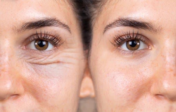 Meso Collagen Trẻ Hóa Da Tại Pleiku – Bí Quyết Làn Da Căng Bóng Tự Nhiên