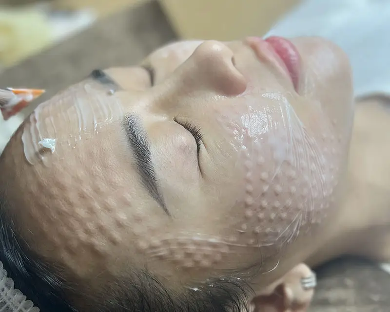 meso cang bong cap am chuyen sau giup da min mang tai kaylyn spa pleiku